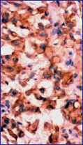 Este anticuerpo (HHF35) inmunomarca las clulas de origen muscular liso y estriado.